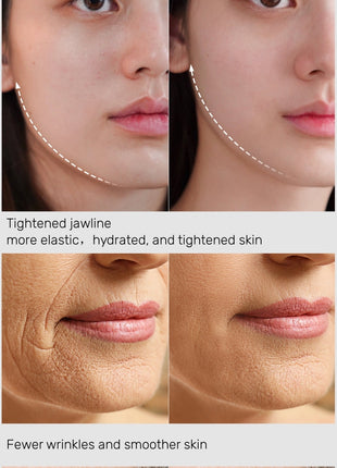 PL038 Prospera RF Radio Frequency 5 in 1 EMS Micro Current LED Light Facial Body Anti Aging Massage Device